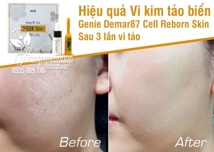 Vi kim tảo biển Genie Demar87 Cell Reborn Skin Hàn Quốc 6