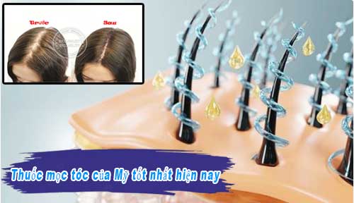 https://www.hangngoainhap.com.vn/cdn3/images/thuoc-moc-toc-cua-my-tot-nhat-hien-nay1.jpg