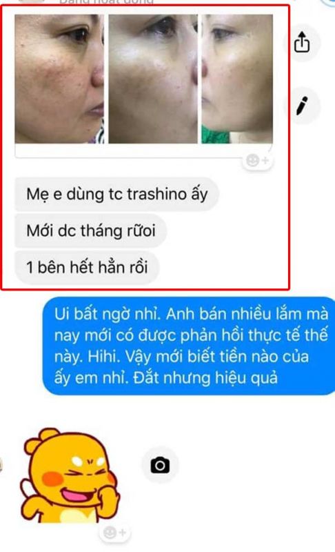 Review tinh chất trị nám transino 30g từ một số khách hàng đã dúng trên fb