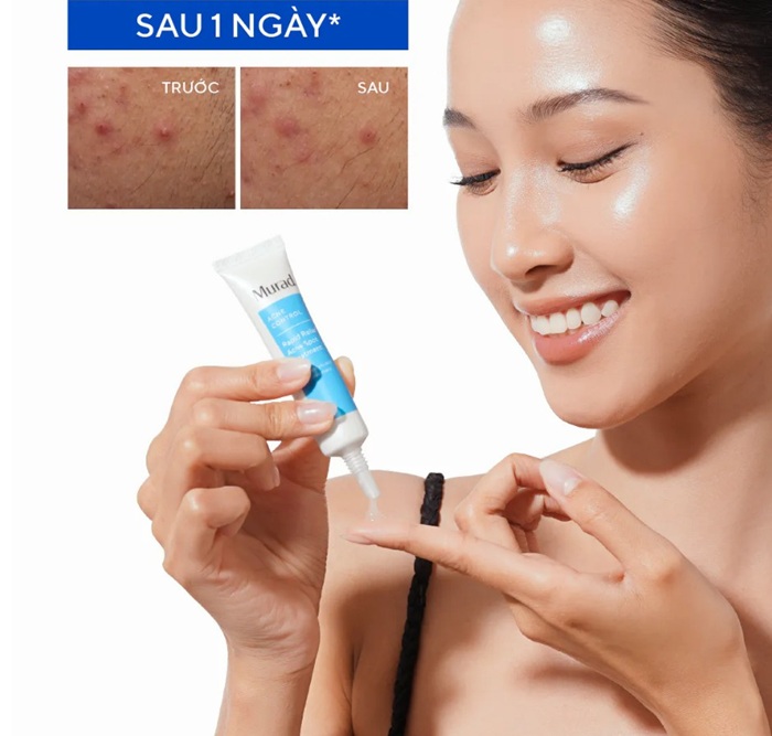 Gel chấm mụn Murad Rapid Relief Acne Spot Treatment 15ml 1