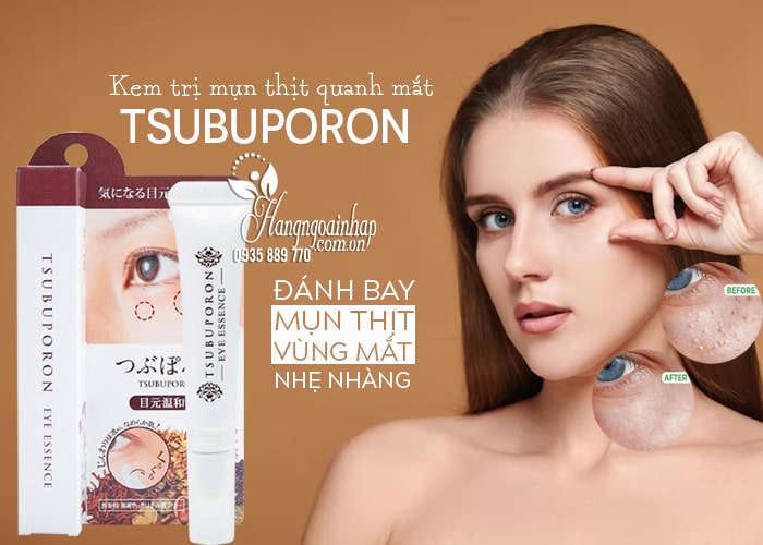 Kem trị mụn thịt quanh mắt Tsubuporon tốt nhất Nhật Bản 5