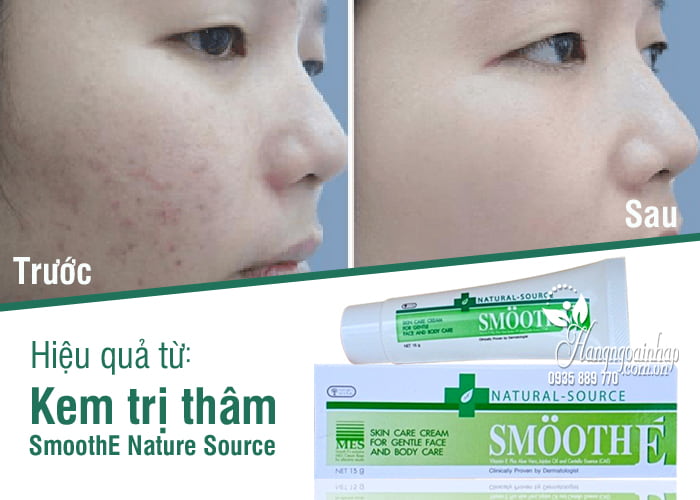 Kem trị thâm SmoothE Natural Source Nhật Bản tuýp 15g 6