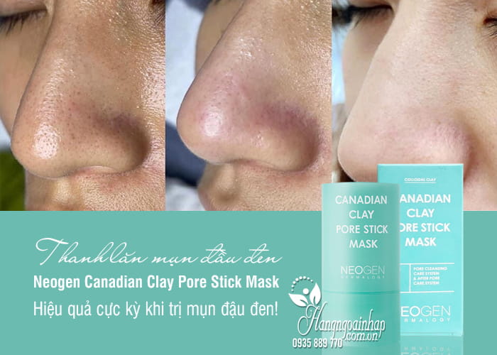 Thanh lăn mụn đầu đen Neogen Canadian Clay Pore Stick Mask 28g 1