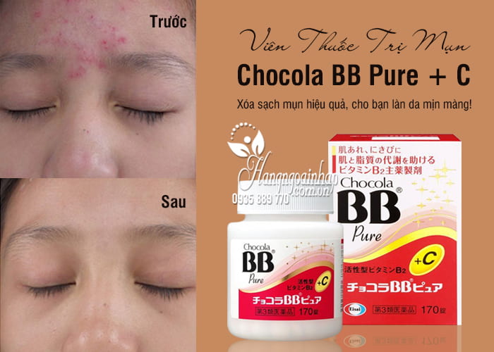 Viên Thuốc Trị Mụn Chocola BB Pure + C Hộp 170 Viên 1