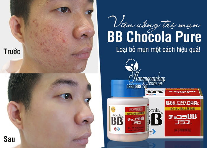 Viên uống trị mụn BB Chocola Pure của Nhật Bản hộp 250 viên 1