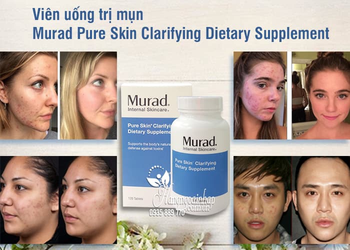Viên uống trị mụn Murad Pure Skin Clarifying Dietary Supplement 7