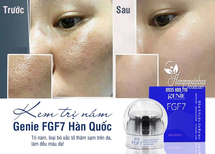 Kem trị nám Genie FGF7 Hàn Quốc chính hãng - Hộp 20g 1