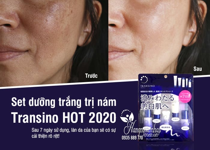 Set dưỡng trắng trị nám Transino 5 món 7 ngày cực HOT 2020 1