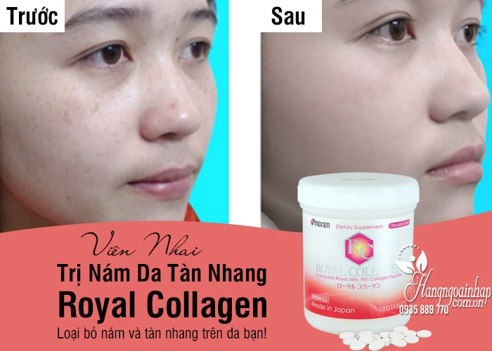 Viên Nhai Trị Nám Da Tàn Nhang Royal Collagen 180 Viên  1