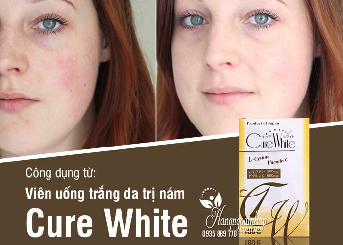 Viên uống trắng da trị nám Cure White Nhật Bản 180 viên 8