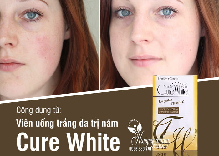 Viên uống trắng da trị nám Cure White Nhật Bản 180 viên 8