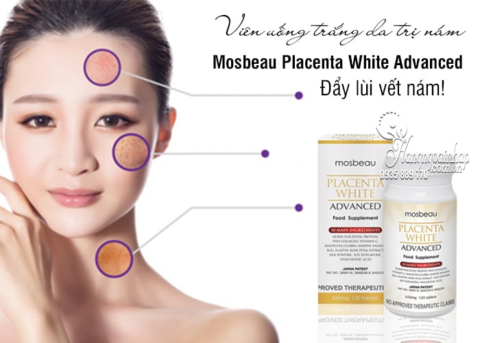 Viên uống trắng da trị nám Mosbeau Placenta White Advanced 1