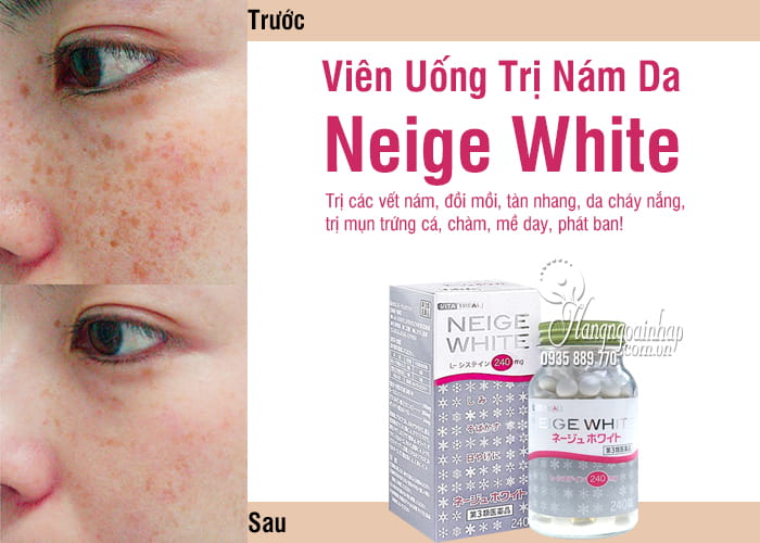 Viên Uống Trị Nám Da Neige White Của Nhật Bản 1