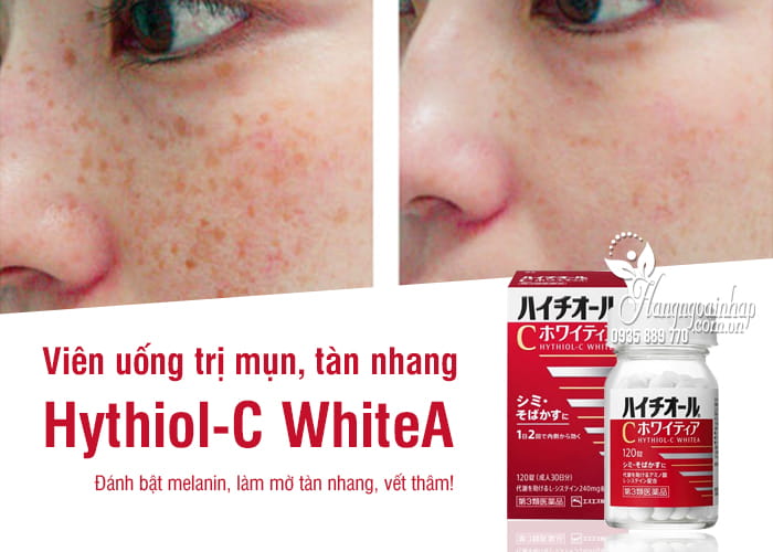 Viên uống Hythiol-C WhiteA 120 viên Nhật, trị mụn, tàn nhang 2