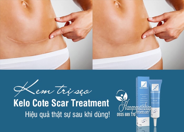 Kem trị sẹo Kelo Cote Scar Treatment 15g chính hãng Mỹ 6