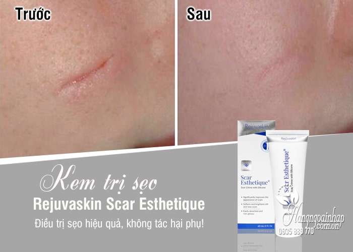 Kem trị sẹo Rejuvaskin Scar Esthetique chính hãng Mỹ 1