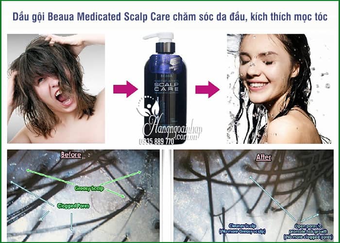 Dầu gội chăm sóc da đầu Beaua Medicated Scalp Care 400ml 8