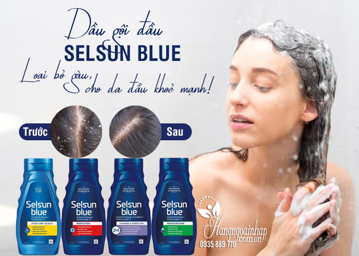 Dầu gội Selsun Blue 325ml của Mỹ chăm sóc da đầu 6