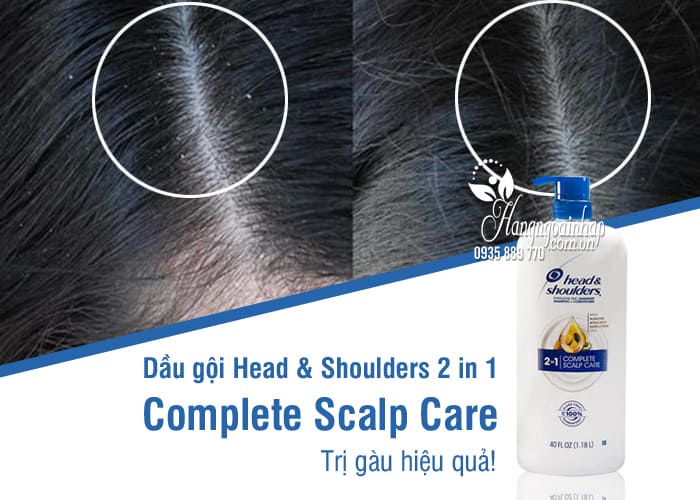 Dầu gội Head & Shoulders 2 in 1 Complete Scalp Care 1,18 lít 7