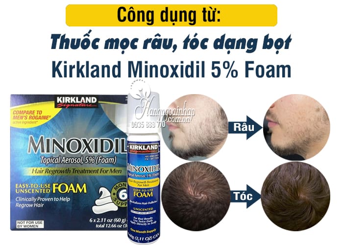 Thuốc mọc râu, tóc Kirkland Minoxidil 5% Foam dạng bọt 3
