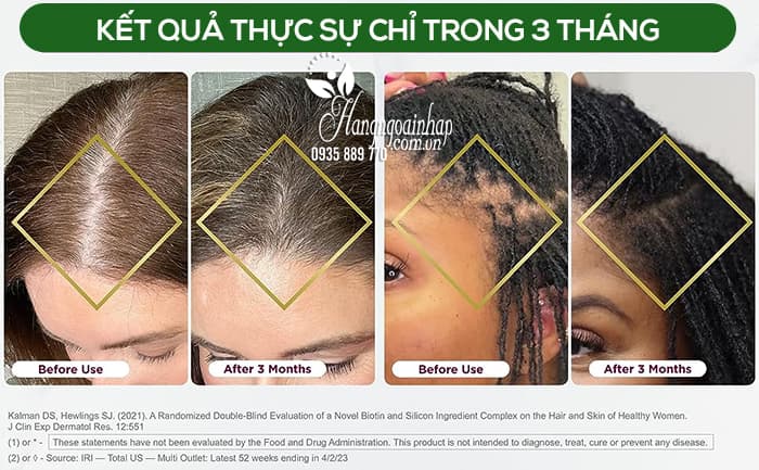 Thuốc mọc tóc Hair Growth Nature’s Bounty của Mỹ 90 viên 1