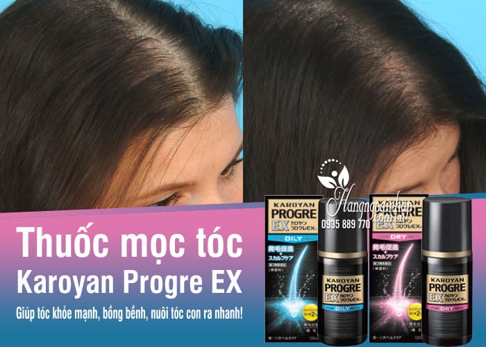 Thuốc mọc tóc Karoyan Progre EX 120ml của Nhật Bản