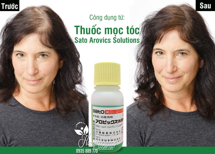 Thuốc mọc tóc Sato Arovics Solutions 5% Nhật Bản lọ 30ml 1