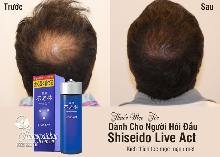 Thuốc Mọc Tóc Shiseido Live Act Dành Cho Người Hói Đầu 1