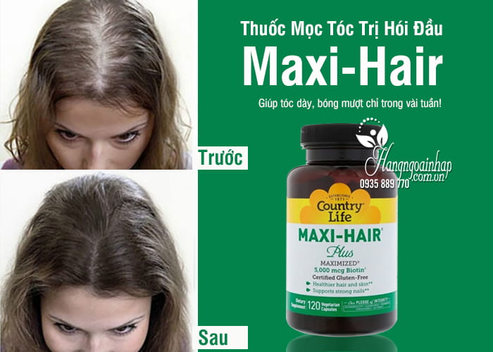 5 Cách điều trị hói đầu ở nam giới kích thích tóc mọc trở lại  VIETSKIN