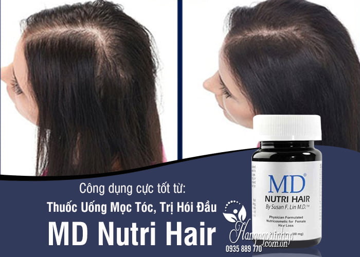 Thuốc Uống Mọc Tóc, Trị Hói Đầu MD Nutri Hair 1