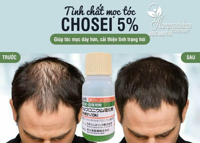 Tinh chất mọc tóc Chosei 5% chai 30ml chính hãng Nhật 4