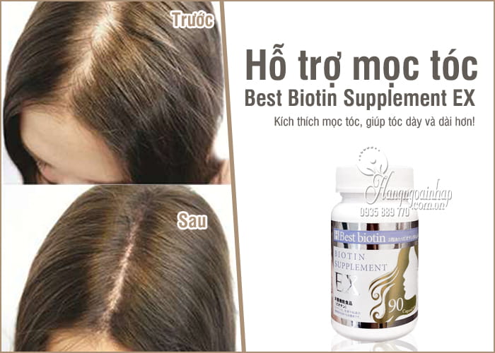 Viên uống hỗ trợ mọc tóc Best Biotin Supplement EX 90 viên Nhật 8