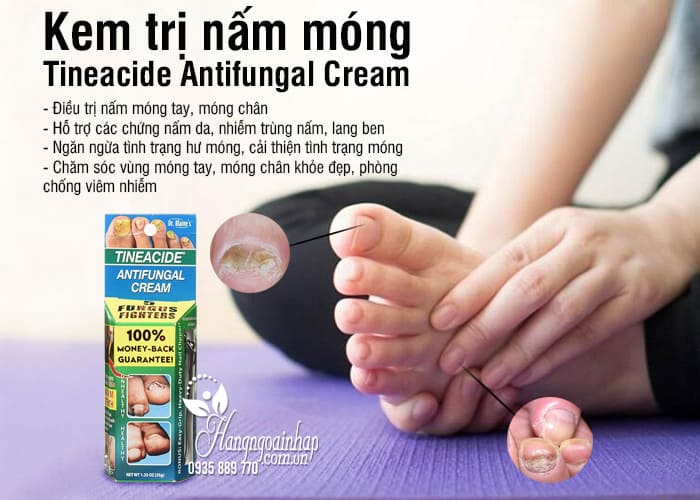 Kem trị nấm móng Tineacide Antifungal Cream 35g của Mỹ 7
