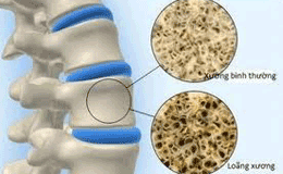 Vai Trò Của Canxi, Cách Bổ Sung Canxi Hiệu Quả