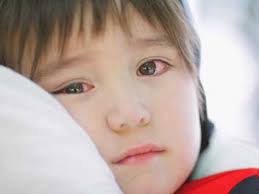 Nguyên nhân và triệu chứng của bệnh đau mắt hột