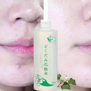 Nước hoa hồng diếp cá Dokudami Natural Skin Lotion Nhật