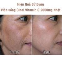 Viên Uống Cinal Vitamin C 2000mg Nhật, trắng da mờ thâm nám