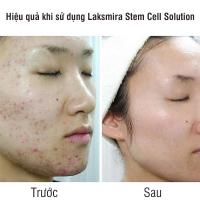 Tế bào gốc Laksmira Stem Cell Solution 10 lọ x 5ml Hàn Quốc