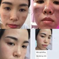 Vi kim tảo biển Genie Demar87 Cell Reborn Skin Hàn Quốc