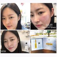 Vi kim tảo biển Genie Demar87 Cell Reborn Skin Hàn Quốc