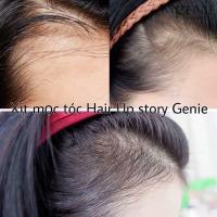 Tinh chất mọc tóc Genie Paris Choi Hair Up Story Hàn Quốc