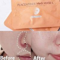 Mặt nạ Royal Placentiner Medi Mask Nhật Bản, hộp 5 miếng