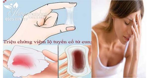 Nguyên nhân viêm cổ tử cung? +Cách điều trị từ chuyên gia