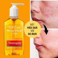 Sữa rửa mặt Neutrogena Oil Free Acne Wash 177ml của Mỹ