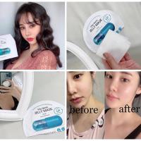 Mặt Nạ Banobagi Vita Genic Của Hàn Quốc