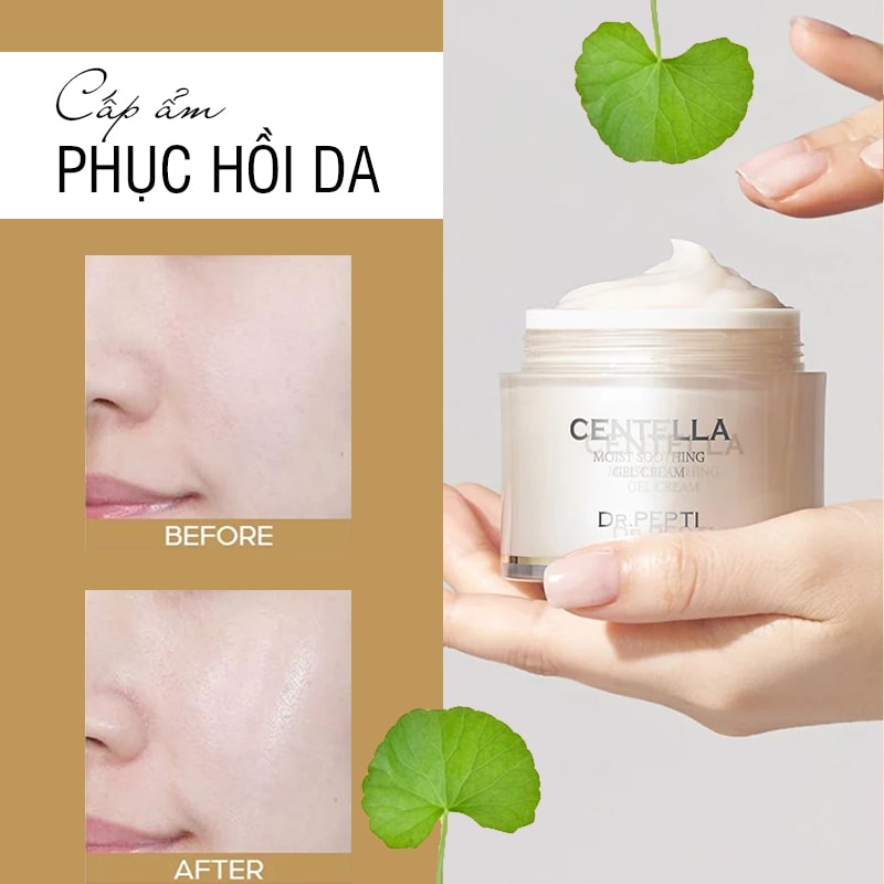 Kem dưỡng Dr.Pepti Centella Moist Soothing Gel Cream, giá tốt