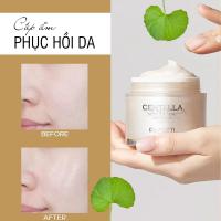 Kem dưỡng ẩm Dr.Pepti Centella Moist Soothing Gel Cream