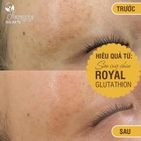 Sữa ong chúa Genie Royal Glutathione 5000mg của Hàn