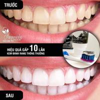 Kem đánh răng Crest 3D White Whitening Therapy 116g