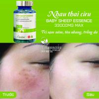 Nhau thai cừu Careline Baby Sheep Essence 33000mg của Úc